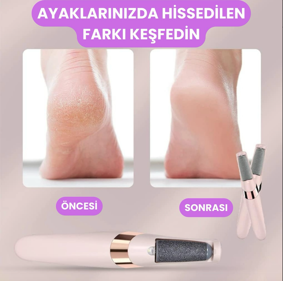 İpeksi™ Pro Ayak Bakım Törpüsü