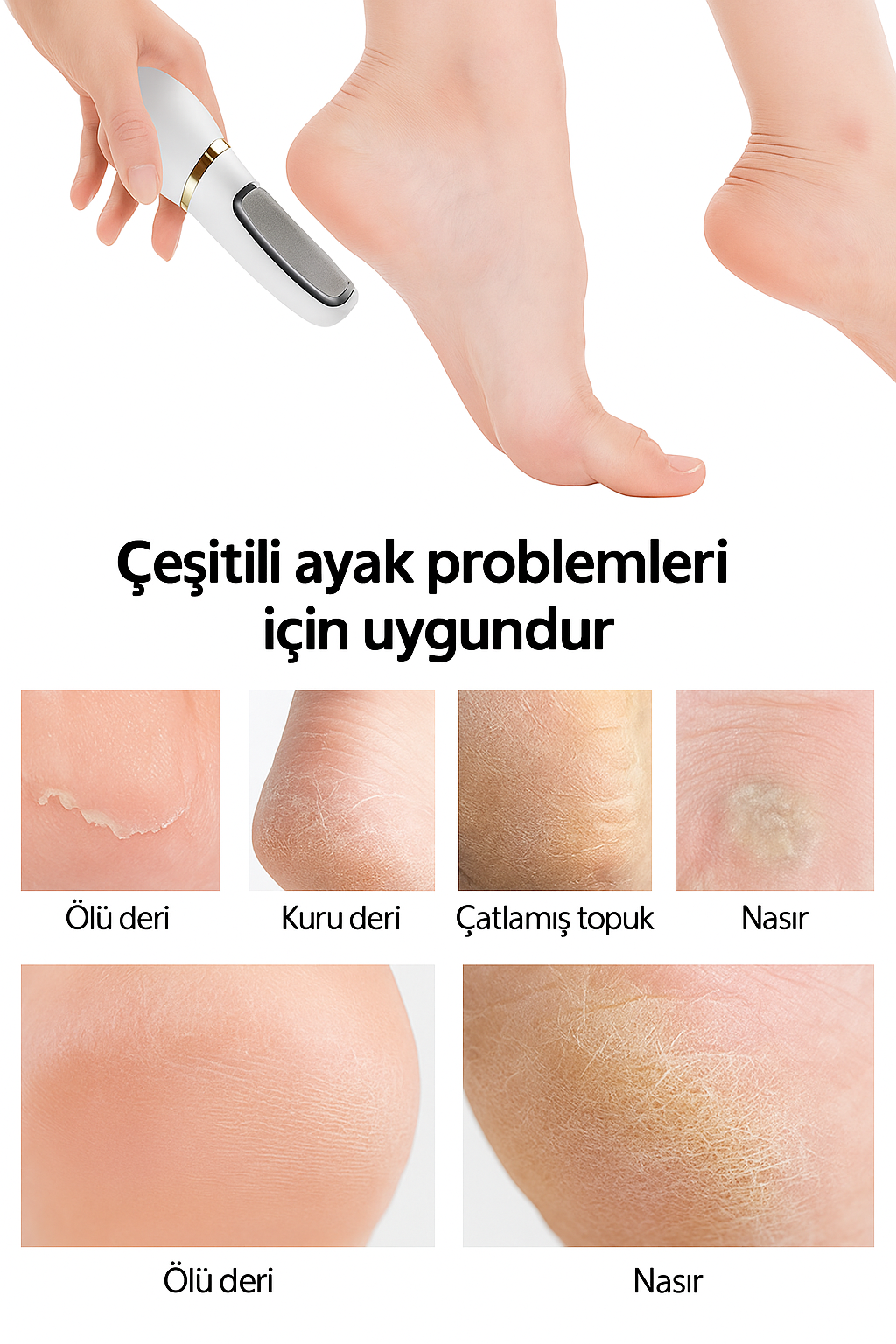 İpeksi™ Pro Ayak Bakım Törpüsü