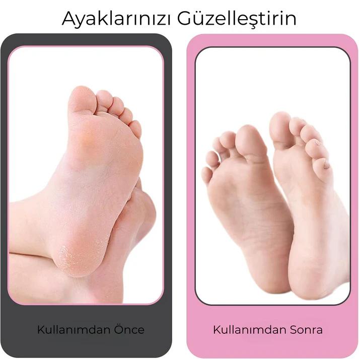 İpeksi™ Pro Ayak Bakım Törpüsü