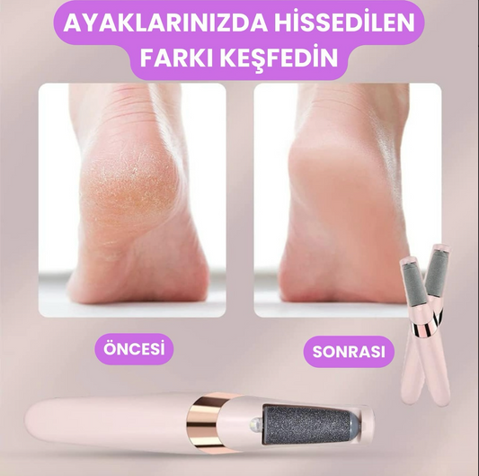 İpeksi™ Pro Ayak Bakım Törpüsü