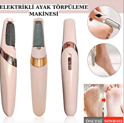 İpeksi™ Pro Ayak Bakım Törpüsü